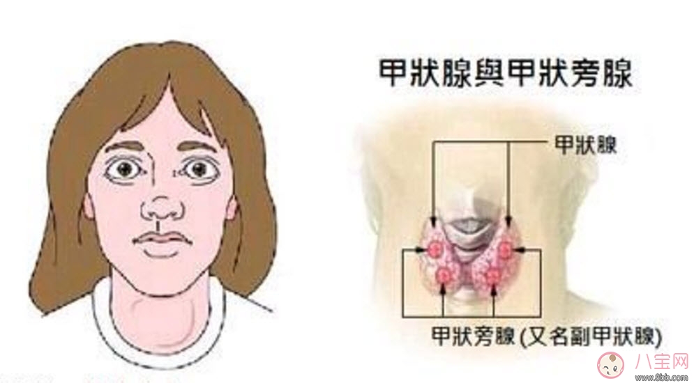 甲亢能懷孕嗎 甲亢懷孕對(duì)胎兒的影響