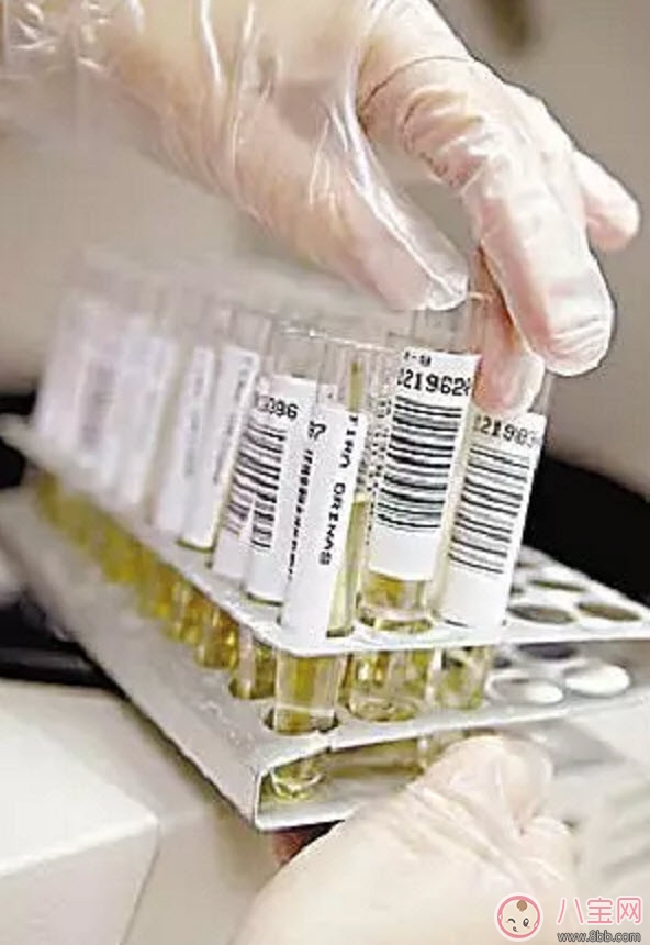 進行驗孕前應該知道哪些常識性問題 可能你還不知道