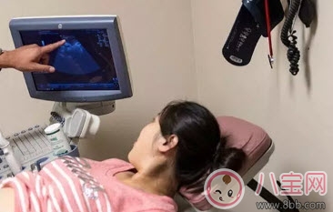 林心如愛吃甜食生女孩  懷孕如何測(cè)男女