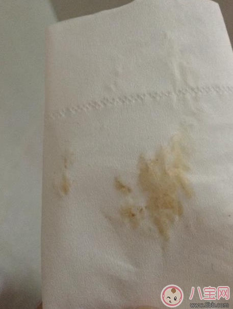 懷孕褐色分泌物是男孩 懷孕初期有褐色分泌物流出是男孩嗎 懷孕褐色分泌物是男孩 懷孕初期有褐色分泌物流出是男孩嗎