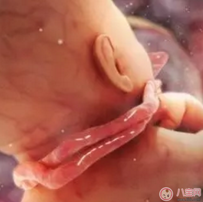 胎兒臍帶繞頸怎么辦？產(chǎn)前怎樣化解臍帶繞頸？