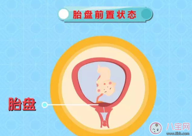 懷孕后那些情況不能順產(chǎn) 有些時(shí)候多聽醫(yī)囑準(zhǔn)沒錯(cuò)