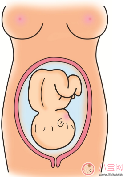 胎位不正只能剖腹產(chǎn)了嗎 怎么讓胎位不正順產(chǎn)