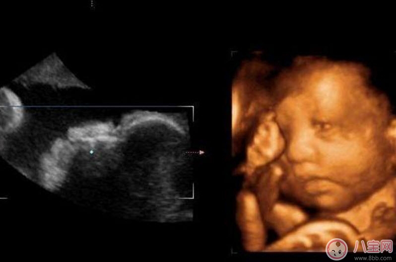 孕婦四維彩超的最佳時間 孕婦一定要做四維彩超嗎 孕婦四維彩超的最佳時間 孕婦一定要做四維彩超嗎