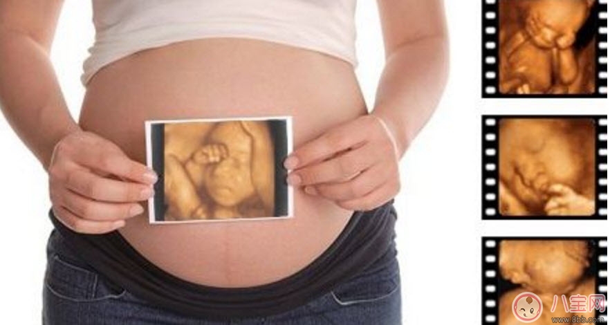 孕婦四維彩超的最佳時間 孕婦一定要做四維彩超嗎 孕婦四維彩超的最佳時間 孕婦一定要做四維彩超嗎