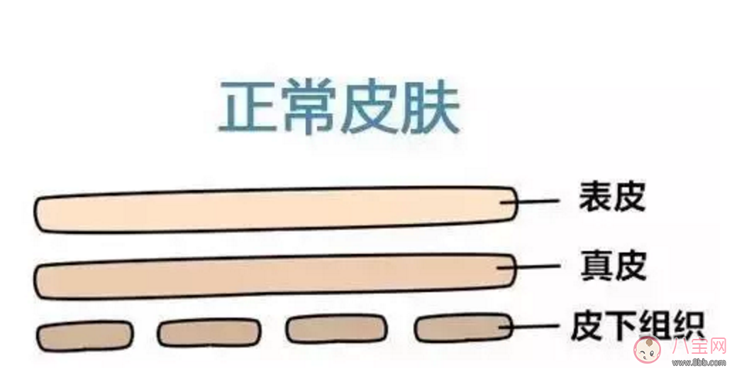 擺脫妊娠紋  哪些方法容易又簡單