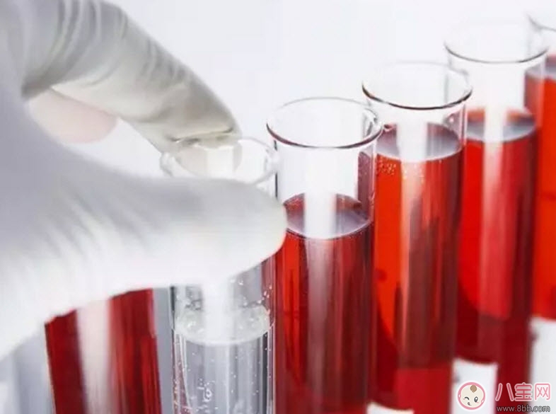 孕婦為什么要驗(yàn)血型 哪些孕婦需要確定血型 孕婦為什么要驗(yàn)血型 哪些孕婦需要確定血型