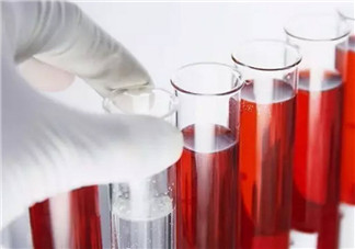 孕婦為什么要驗(yàn)血型 哪些孕婦需要確定血型