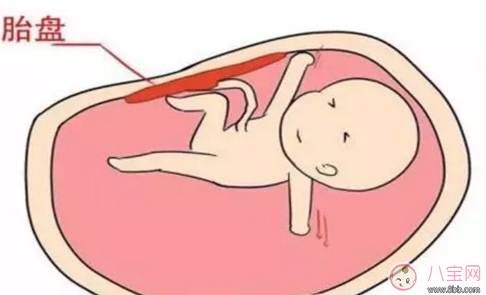 胎盤三級就已經(jīng)老化了嗎 胎盤老化判斷標(biāo)準(zhǔn)