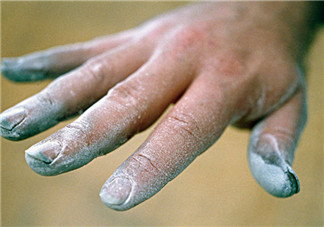 孕婦得了灰指甲怎么辦 孕婦的灰指甲會影響胎兒嗎