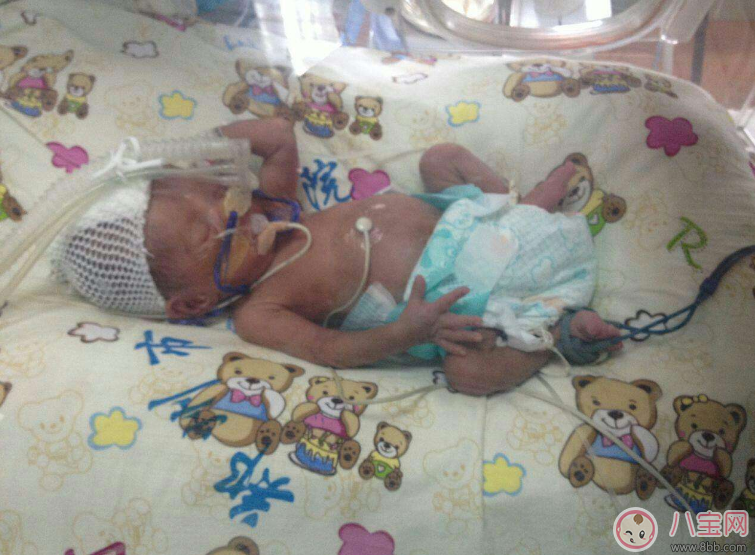 哪些準(zhǔn)媽媽容易早產(chǎn) 早產(chǎn)準(zhǔn)媽媽特征