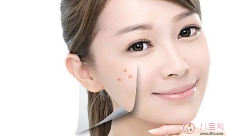 孕婦孕期長(zhǎng)痘痘怎么辦 孕期痘痘怎么調(diào)理(長(zhǎng)痘痘吃什么)