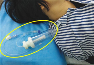 剖腹產(chǎn)的過程是怎么樣的 剖腹產(chǎn)手術(shù)前手術(shù)中手術(shù)后流程揭秘