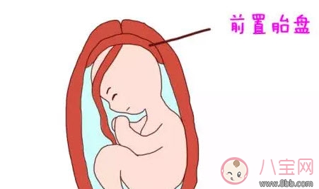 什么是孕晚期見紅 孕晚期見紅肚子疼怎么辦