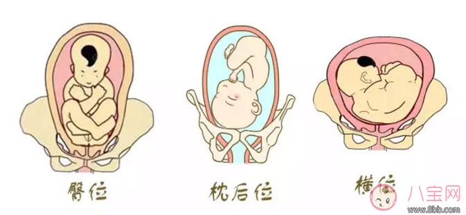 孕晚期胎位不正怎么辦 孕晚期胎位圖