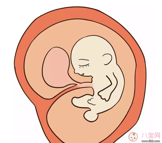 孕晚期羊水過多怎么辦 羊水過多的原因 孕晚期羊水過多怎么辦 羊水過多的原因