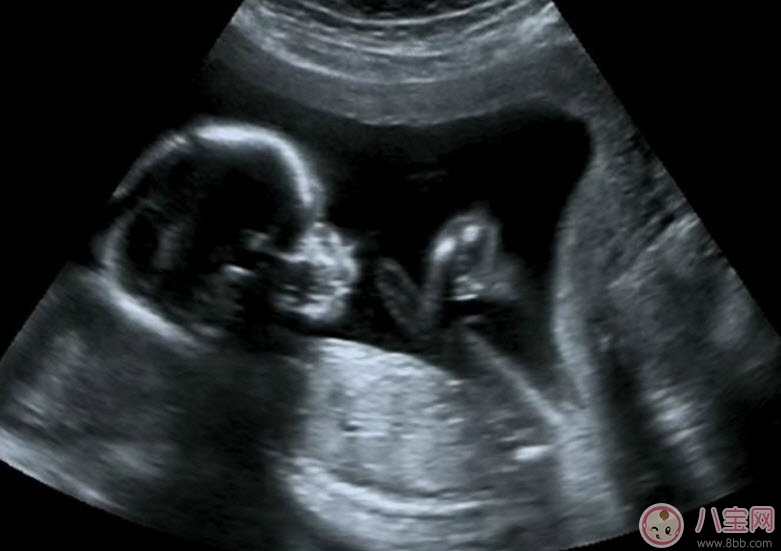 孕早期做陰道B超會影響胎兒嗎 陰式b超和b超的區(qū)別