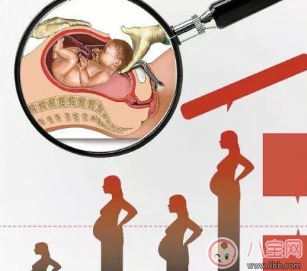 剖腹產(chǎn)孕婦會不會感到疼痛 剖腹產(chǎn)橫剖還是縱剖。