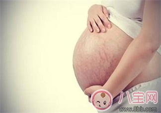 妊娠紋什么時候長    怎么預防妊娠紋