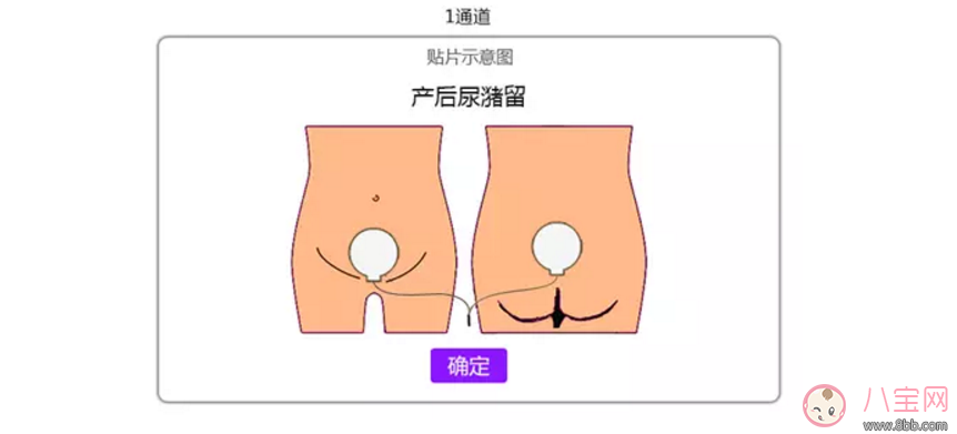 產(chǎn)后排尿難的原因 如何促進(jìn)排尿 產(chǎn)后排尿難的原因 如何促進(jìn)排尿