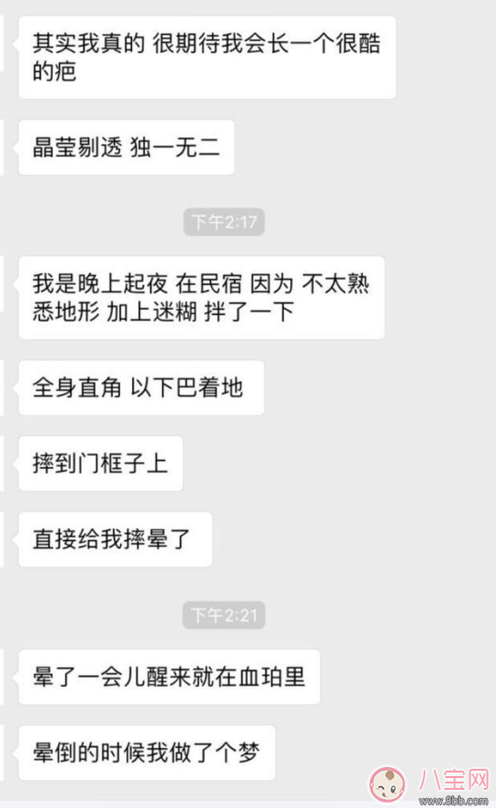 周冬雨下巴為什么會出現(xiàn)疤痕 周冬雨下巴受傷的原因 周冬雨下巴為什么會出現(xiàn)疤痕 周冬雨下巴受傷的原因