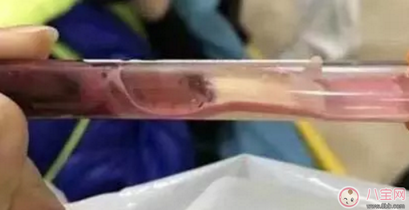 1歲男童吃西蘭花中毒 西蘭花燒制禁忌 1歲男童吃西蘭花中毒 西蘭花燒制禁忌