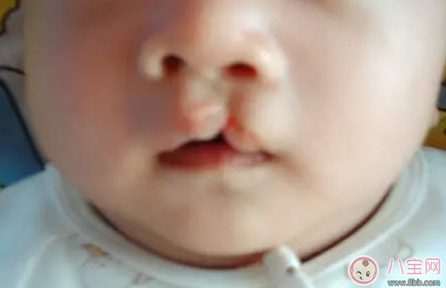 孕婦能吃兔肉嗎 孕婦吃兔肉對(duì)寶寶有什么好處 孕婦能吃兔肉嗎 孕婦吃兔肉對(duì)寶寶有什么好處