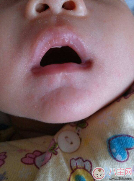 秋季寶寶嘴唇易起皮 寶寶使用唇膏推薦