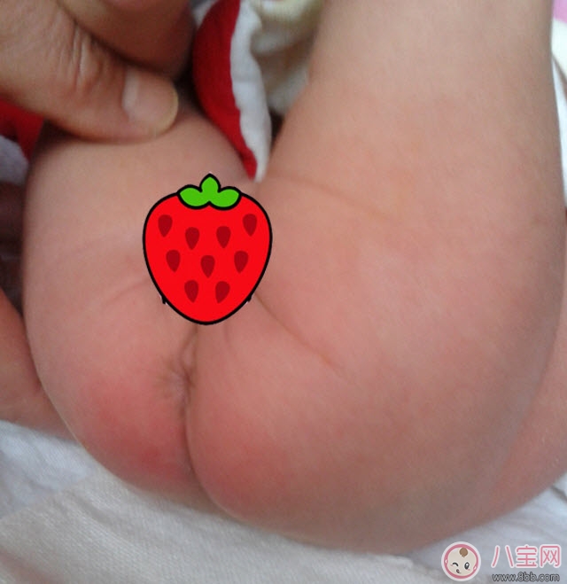 貝親護(hù)臀膏可以擦臉嗎 貝親嬰兒護(hù)臀膏能天天用嗎 貝親護(hù)臀膏可以擦臉嗎 貝親嬰兒護(hù)臀膏能天天用嗎