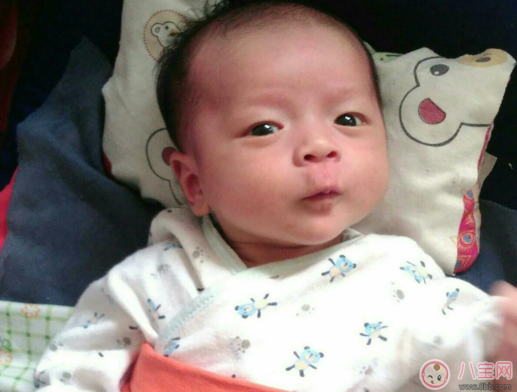 這些情況居然是奶粉過敏 怎么知道孩子吃奶粉過敏了