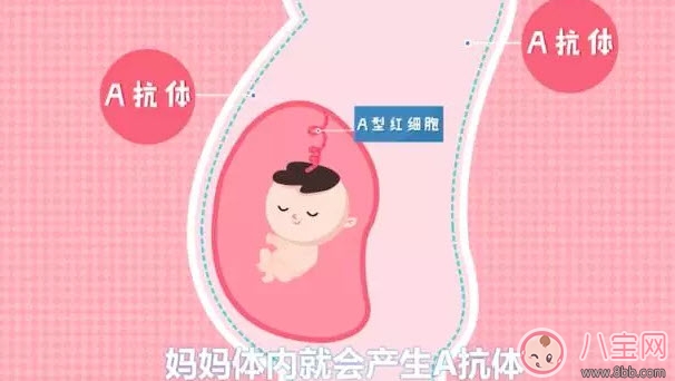 新生兒溶血癥有哪些癥狀 孕婦檢查寶寶ABO溶血癥是騙錢的 新生兒溶血癥有哪些癥狀 孕婦檢查寶寶ABO溶血癥是騙錢的