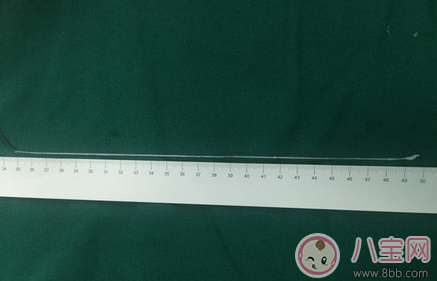 喝生水長(zhǎng)寄生蟲是真的嗎 喝生水會(huì)有寄生蟲嗎 喝生水長(zhǎng)寄生蟲是真的嗎 喝生水會(huì)有寄生蟲嗎