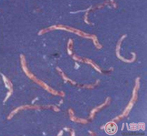 喝生水長(zhǎng)寄生蟲是真的嗎 喝生水會(huì)有寄生蟲嗎 喝生水長(zhǎng)寄生蟲是真的嗎 喝生水會(huì)有寄生蟲嗎