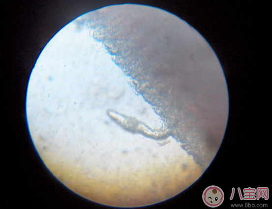 喝生水長(zhǎng)寄生蟲是真的嗎 喝生水會(huì)有寄生蟲嗎 喝生水長(zhǎng)寄生蟲是真的嗎 喝生水會(huì)有寄生蟲嗎