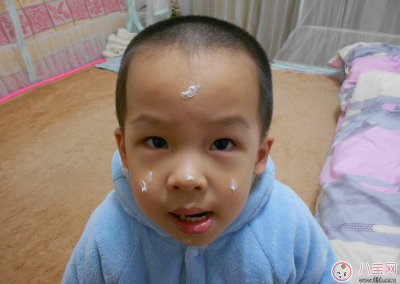 孩子皮膚變差怎么辦 秋季孩子護(hù)膚方法