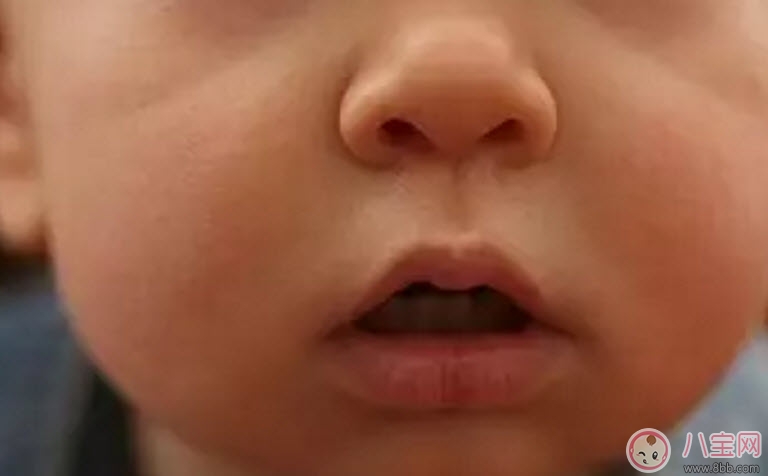 秋天怎么預防寶寶口角炎 寶寶口角炎的食療方法