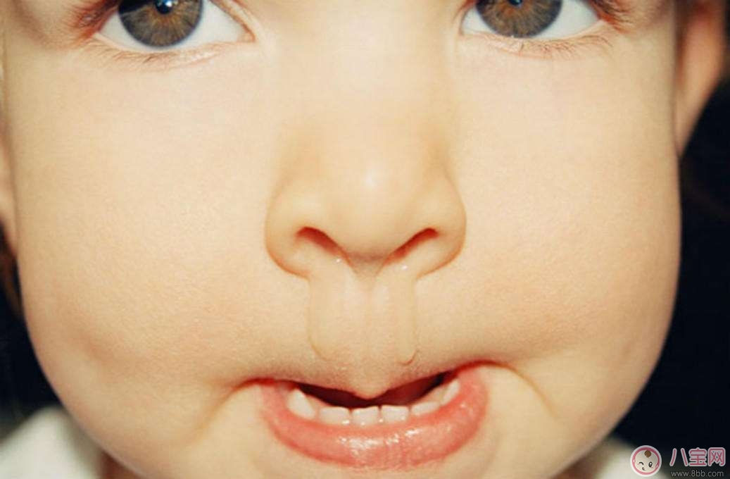 寶寶流鼻涕的原因 如何緩解寶寶流鼻水的問(wèn)題