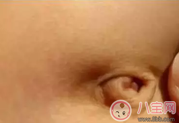 孩子肚臍臟了怎么辦 就算你有強迫癥也不能摳