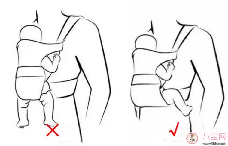 嬰兒為什么是青蛙腿 寶寶青蛙腿用不用綁腿 嬰兒為什么是青蛙腿 寶寶青蛙腿用不用綁腿