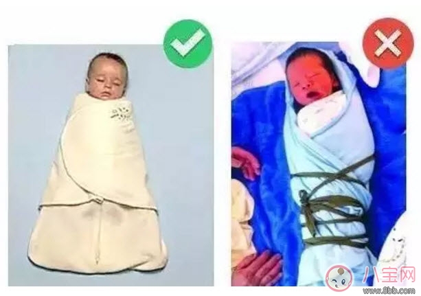 嬰兒為什么是青蛙腿 寶寶青蛙腿用不用綁腿 嬰兒為什么是青蛙腿 寶寶青蛙腿用不用綁腿