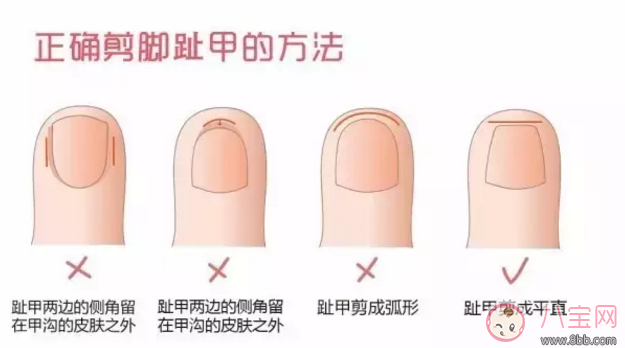 錯誤的方法剪指甲會剪到肉 怎么給孩子剪指甲 錯誤的方法剪指甲會剪到肉 怎么給孩子剪指甲