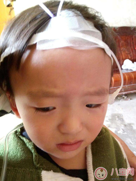 秋季腹瀉孩子狀態(tài)差 及時(shí)預(yù)防遠(yuǎn)離它 秋季腹瀉孩子狀態(tài)差 及時(shí)預(yù)防遠(yuǎn)離它