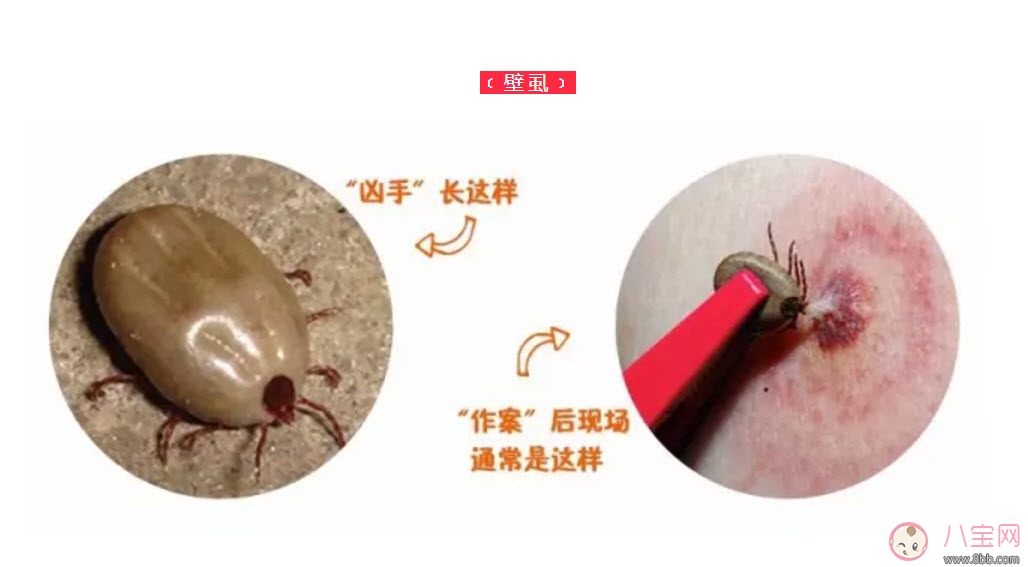 寶寶被蜱蟲咬了癥狀圖片 寶寶被蜱蟲咬和蚊子咬癥狀對比圖片區(qū)別 寶寶被蜱蟲咬了癥狀圖片 寶寶被蜱蟲咬和蚊子咬癥狀對比圖片區(qū)別