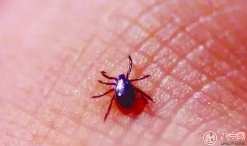 寶寶被蜱蟲咬了癥狀圖片 寶寶被蜱蟲咬和蚊子咬癥狀對比圖片區(qū)別 寶寶被蜱蟲咬了癥狀圖片 寶寶被蜱蟲咬和蚊子咬癥狀對比圖片區(qū)別