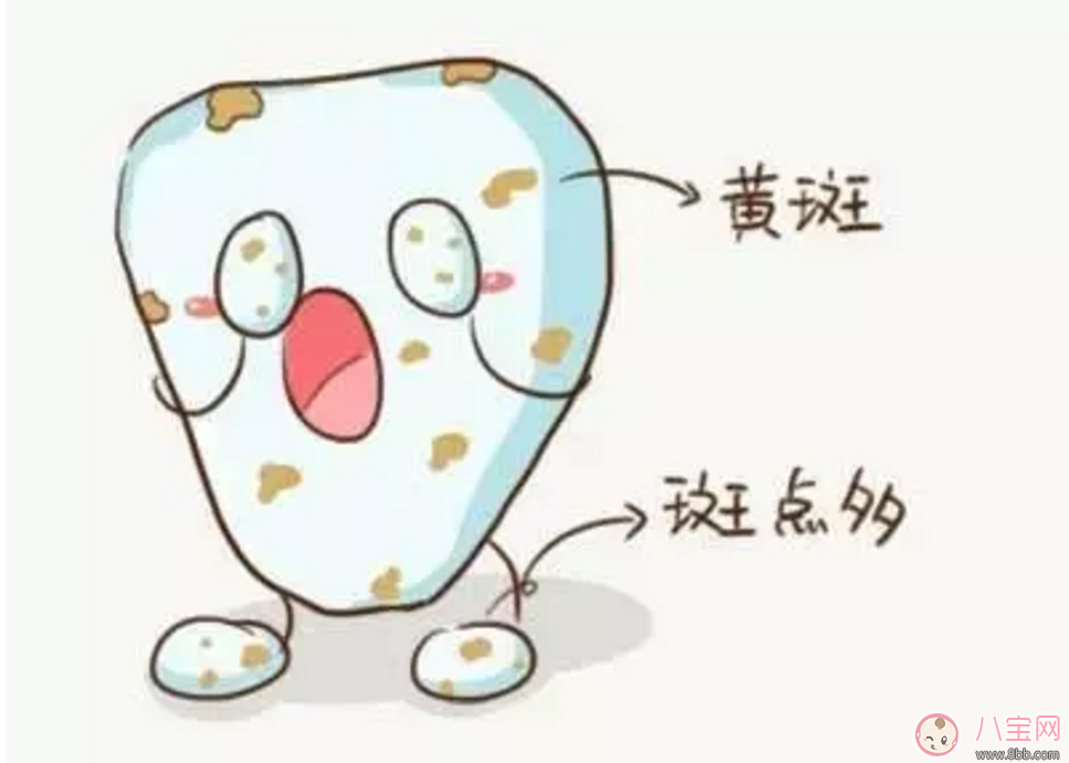 寶寶沒有齲齒 卻有黑牙是怎么回事？