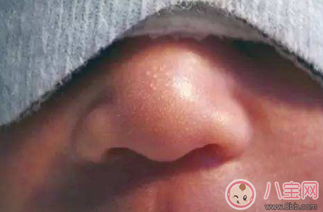 新生兒鼻尖上起了好多小白點是什么 寶寶鼻子上有小白點 新生兒鼻尖上起了好多小白點是什么 寶寶鼻子上有小白點