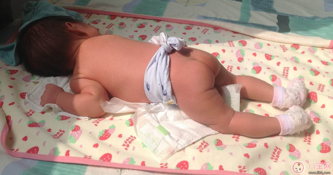 覺得孩子越曬越健康 不要把孩子曬傷了再去后悔 覺得孩子越曬越健康 不要把孩子曬傷了再去后悔