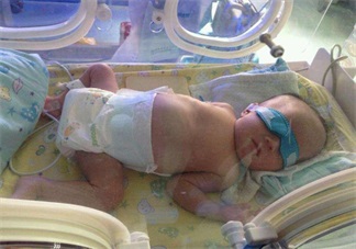 早產寶寶太小怎么照顧 各項注意到一樣是個健康寶寶