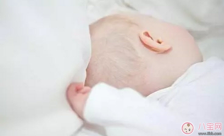 新生兒頭上的乳痂一般什么時(shí)候消失 為什么有的寶寶長(zhǎng)乳痂有的不長(zhǎng) 新生兒頭上的乳痂一般什么時(shí)候消失 為什么有的寶寶長(zhǎng)乳痂有的不長(zhǎng)