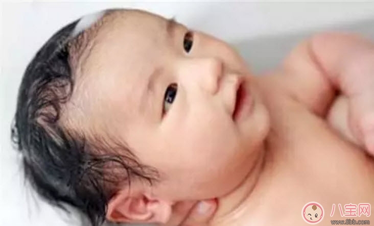 新生兒頭上的乳痂一般什么時(shí)候消失 為什么有的寶寶長(zhǎng)乳痂有的不長(zhǎng) 新生兒頭上的乳痂一般什么時(shí)候消失 為什么有的寶寶長(zhǎng)乳痂有的不長(zhǎng)